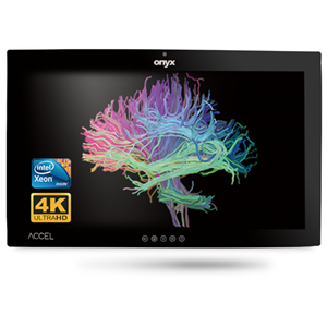 Onyx ACCEL-A3201 i7 32" 4K OR Station PCAP Touch