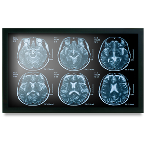 Onyx MEDDP-622HPN 21.5" Medical Touch Display